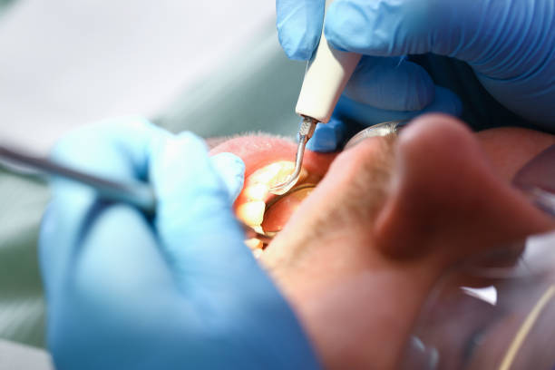 Best Weekend Emergency Dentist in Ansted, WV