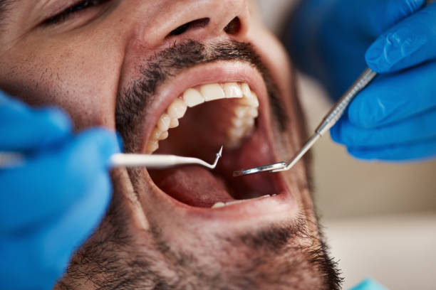 Best Emergency Dental Care for Broken or Chipped Teeth in Ansted, WV